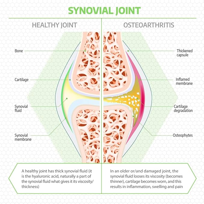 Fluid Motion - Hip & Joint Support for Dogs - Liquid Hyaluronic Acid - Joint Mobility, Skin, & Coat Supplement for Senior Dogs - Apple Flavor - Glucosamine Alternative (30-60+ Day Supply)