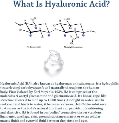 Hyalogic HyaFlex Pro-Complete Dog Joint Supplement, Canine Joint Support – Hyaluronic Acid Joint Supplement for Dogs –w/Glucosamine MSM Supplement 30-60 Day Supply, Cartilage & Coat Supplement