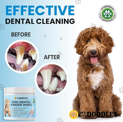 We Love Doodles 50 pcs Dog Teeth Cleaning Wipes & 150 pcs Dog Eye Wipes Bundle - Pet Dental Finger Wipes for Dogs, Freshens Breath Dog Dental Wipes, Pet Eye Wipes Pads & Safe Dog Eye Cleaner