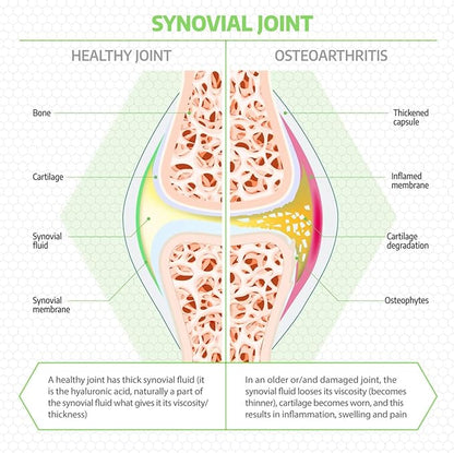 Fluid Motion - Hip & Joint Support for Dogs - Liquid Hyaluronic Acid - Joint Mobility, Skin, & Coat Supplement for Senior Dogs - Apple Flavor - Glucosamine Alternative (30-60+ Day Supply)